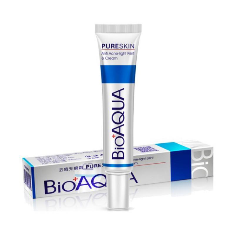 Body Acne Treatment Cream