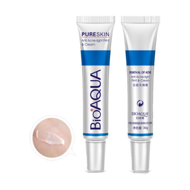 Body Acne Treatment Cream